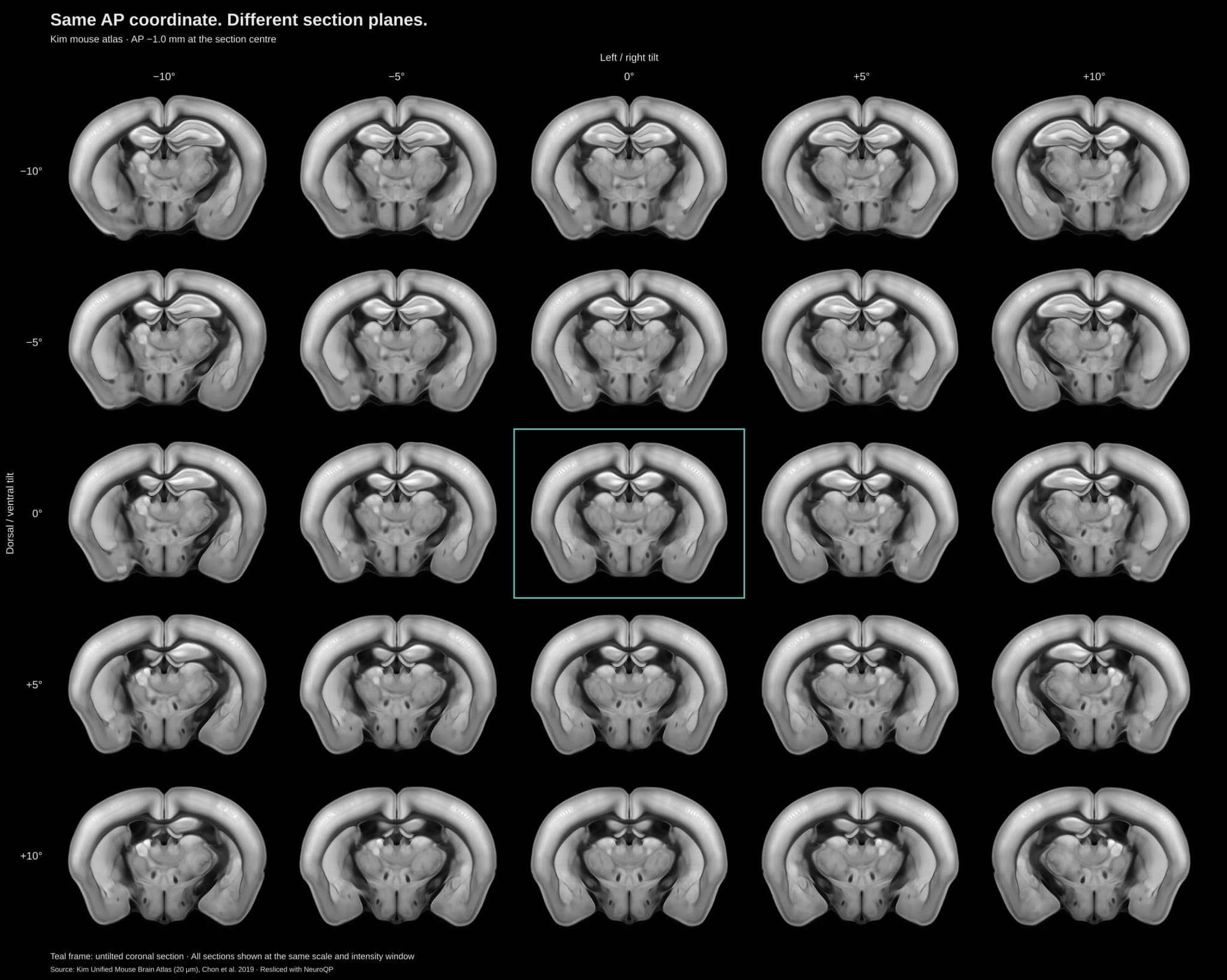 Twenty-five Kim mouse atlas sections at AP −1.0 mm, with left/right tilt varying across columns and dorsal/ventral tilt across rows
